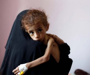 یمن میں تین سالہ جنگ کے دوران قحط سالی کے باعث 85 ہزار بچے ہلاک
