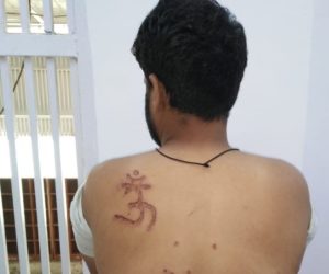 تہاڑ جیل: مسلم قیدی نبیر کی پشت پر سلاخ سے جبراً ہندو مذہبی نشان کا بنوانا جیلر کے غیر انسانی سلوک و تعصب کی بدترین مثال