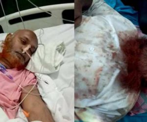 موب لنچنگ کا ایک اور اندوہناک واقعہ : گالی گلوچ کے بعد داڑھی نوچ کر پٹائی، زخمی انظار دوران علاج فوت