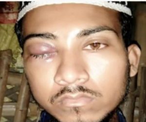 مغربی بنگال میں ایک مسلمان پر بھگوا دہشت گردوں کا حملہ. جے شری رام کا نعرہ لگانے کیلئے کیا گیا تھا مجبور