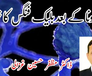 کورونا کے بعد بلیک فنگس کا خوف