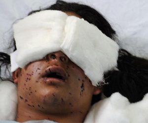 بھارت کشمیر میں بچوں کے خلاف پیلٹ گن کا استعمال بند کرے: اقوام متحدہ